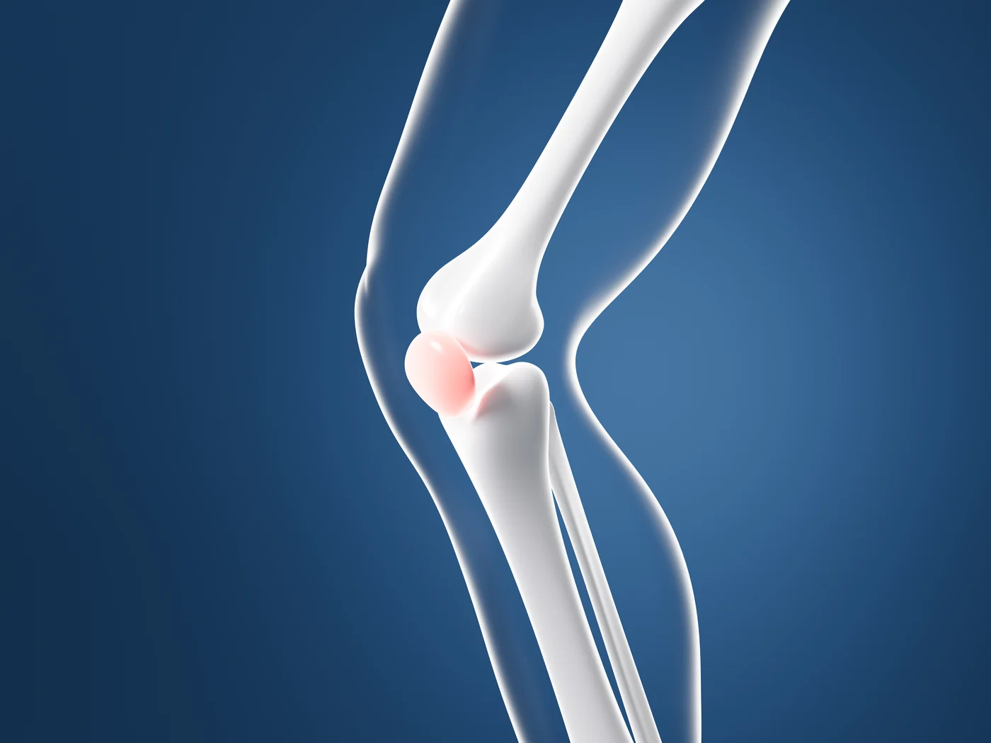 Anatomical model of the knee with the kneecap highlighted
